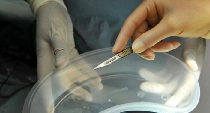 China Tangkap Dokter-Dokter yang Ambil Organ Tubuh Korban Kecelakaan