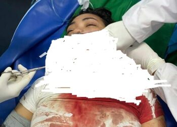 Depresi Gajinya Dibawa Kabur Agency, Seorang Wanita Cantik yang Tengah Hamil Muda Nekat Terjun dari Lantai 3 Kawasan Nagoya Suare