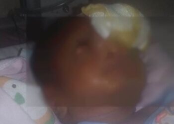 Demi Obati Benjolan Bayi Usia 10 Hari, Sang Bapak Gadaikan Rumahnya Rp 3 Juta ke Tetangga