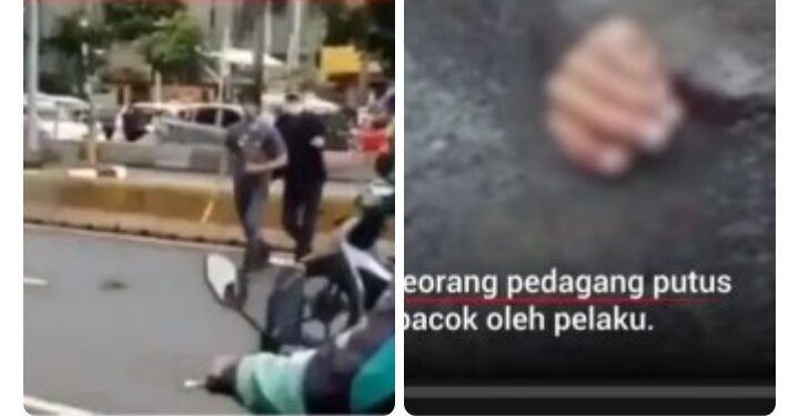Merasa Ditipu, Pembeli Tebas Tangan Pedagang Dengan Golok Hingga Putus