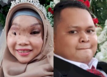 Definisi Cinta Tak Kenal Fisik, Wanita Korban Kecelakaan Perahu Kini Sudah di Pelaminan
