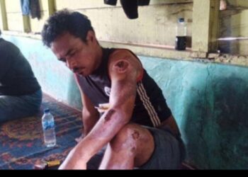 Niat Kejar Maling Kerbau, Pria Ini Justru Kehilangan Nyawa Anaknya karena Ditabrak Mobil si Pencuri