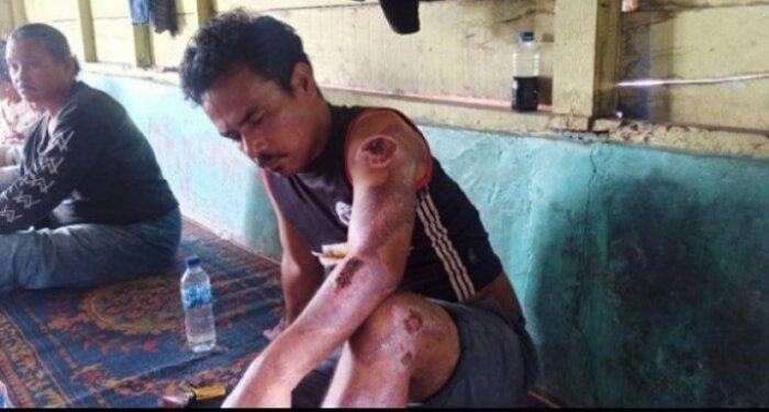 Niat Kejar Maling Kerbau, Pria Ini Justru Kehilangan Nyawa Anaknya karena Ditabrak Mobil si Pencuri