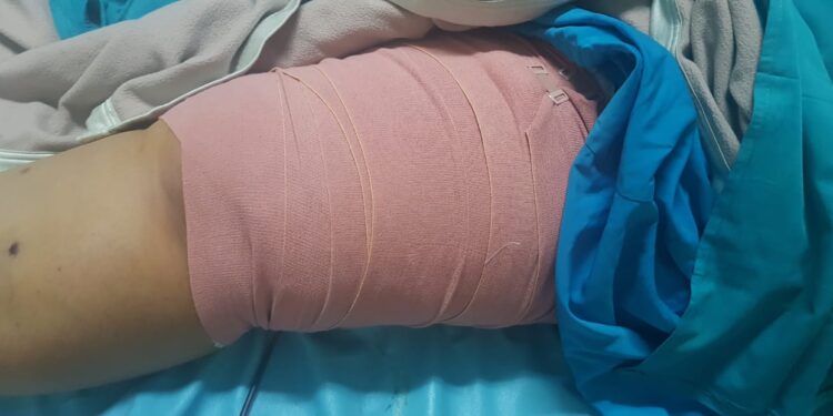 Korban Robohnya Pelantar Penghubung Pelabuhan Tanjunguban, Florida: Dinas Perhubungan Bintan Tidak Ada Perhatian Untuk Menjenguk