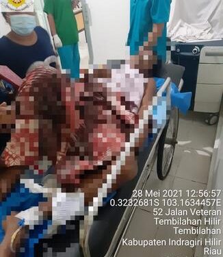 Sakit Hati Istri Menikah, Pria ini  Suruh Orang Tikam Suami Mantan Istrinya