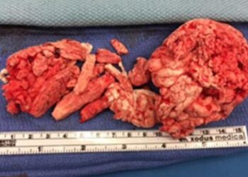 Parah! Istri Masukkan Busa Pengeras ke Penis Suami agar Ereksi, Ini Akibatnya