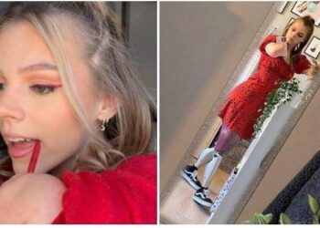 Semangat Hidup Isabelle, Gadis Tangan dan Kakinya Diamputasi, Jadi Selebgram Riasannya Bikin Takjub