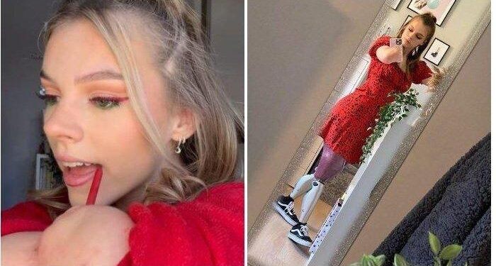 Semangat Hidup Isabelle, Gadis Tangan dan Kakinya Diamputasi, Jadi Selebgram Riasannya Bikin Takjub