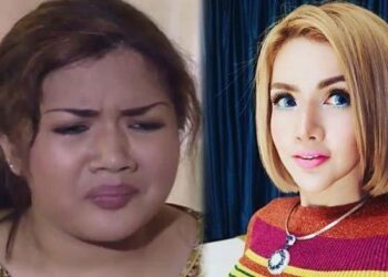 Artis Ini Habiskan Rp 4 Miliar untuk Permak Wajah, Tapi Ibunya Cuma Dikasih Rp 500 Ribu Setiap Bulan