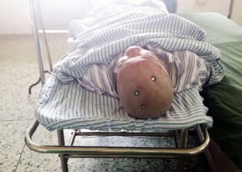 Dukun Yang Tancapkan Paku Di Kepala Agar Melahirkan Bayi Laki-Laki Diburu Polisi