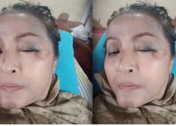 Kasihan Pedangdut 51 Tahun Ini, Pingsan Korban Tabrak Lari Angkot, Pernah Dinikahi Menteri