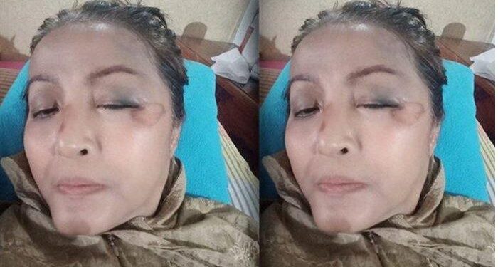 Kasihan Pedangdut 51 Tahun Ini, Pingsan Korban Tabrak Lari Angkot, Pernah Dinikahi Menteri