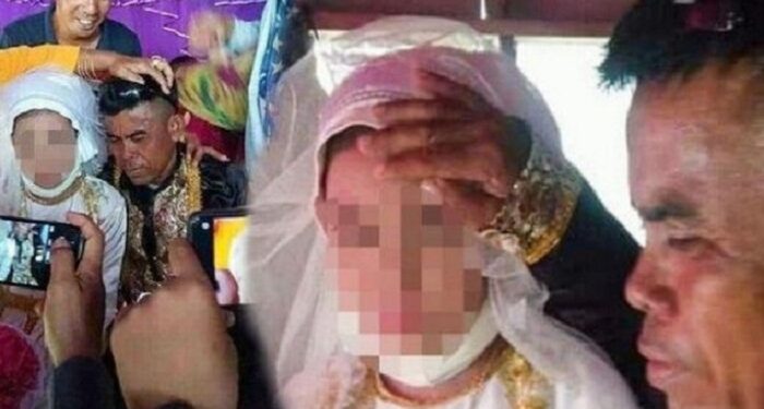 Baru 13 Tahun Siswi SMP Dipaksa Nikah dengan Pria 48 Tahun, Ini Tampang Suaminya