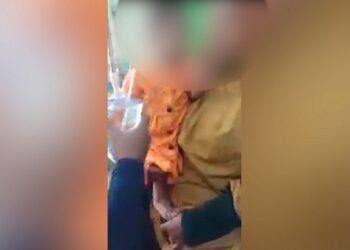 Bayi 15 Bulan Alami Pendarahan Di Organ Intim