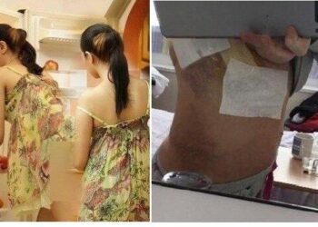 Hampir Mati Janda Muda Mau Dipacari Berondong, Tulang Rusuk Patah Ternyata Pacarnya Psikopat