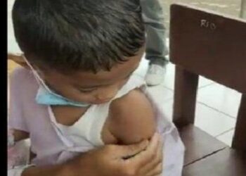 Heboh! Bocah Ini Kebal Jarum Suntik saat Vaksinasi Covid-19, Dinkes Kaget