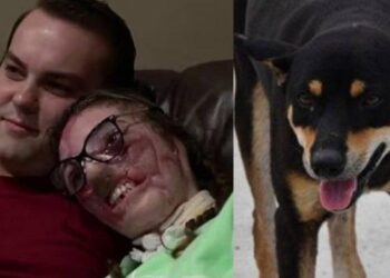 Wanita Beruntung, Wajahnya Hancur Digigit Anjing 800 Kali, Kakasihnya Masih Setia Menemani