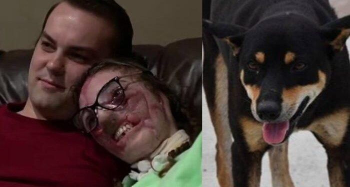 Wanita Beruntung, Wajahnya Hancur Digigit Anjing 800 Kali, Kakasihnya Masih Setia Menemani