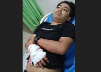 Nyaris Dibunuh Geng Motor, Korban Sempat Tandai Wajah Pelaku Saat Dibacoki