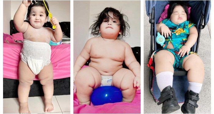 Viral Bocah 2 Tahun Pakai Popok Dewasa, Dilakukan Sejak Usia 1 Tahun, Miliki Bobot 30 Kg