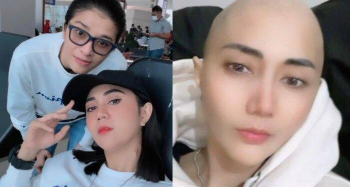 Kasihan Artis Cantik Ini, Dulu Rambut Panjang Kini Harus Botak, Ternyata Idap Kanker Ganas Mematikan