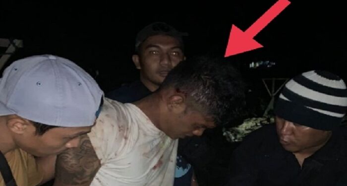 2 Anggota Polisi Ditusuk Pengedar saat Nyamar Jadi Pembeli Narkoba, Begini Kejadiannya