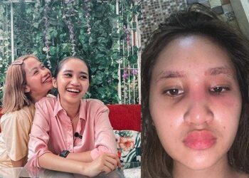 Nasib Artis Mantan TKW Hamil Di Umur 16 Tahun, Sabar Rawat Anak Tanpa Suami, Ibunya Sudah Memaafkan