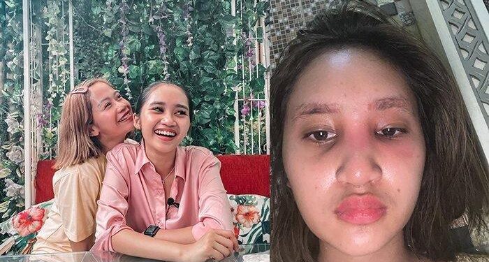 Nasib Artis Mantan TKW Hamil Di Umur 16 Tahun, Sabar Rawat Anak Tanpa Suami, Ibunya Sudah Memaafkan