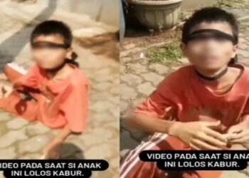 Bocah di Bekasi Kabur dari Rumah dengan Kaki Dirantai, Kelaparan dan Minta Makan ke Tetangga