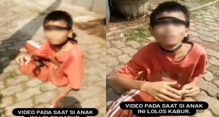 Bocah di Bekasi Kabur dari Rumah dengan Kaki Dirantai, Kelaparan dan Minta Makan ke Tetangga