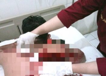 Bentrok Antar Ormas Ditengarai Penurunan Spanduk, Satu Orang Alami Luka Bacok Parah