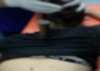 Cekcok Tak Dibuatkan Makanan, Suami Tusuk Punggung Istri hingga Tewas