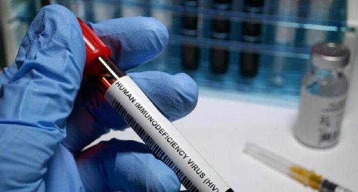 Suami ‘Jajan’ Bikin Ratusan Ibu Positif HIV, Harus Apa Biar Anak Tak Tertular?