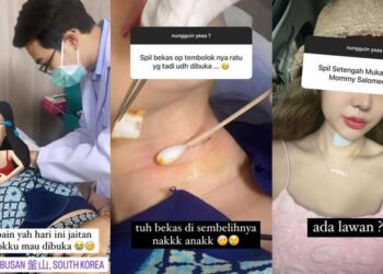 Kondisi Terkini Lucinta Luna Pasca Jahitan ‘Khodam’ Dibuka                                                