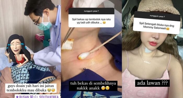 Kondisi Terkini Lucinta Luna Pasca Jahitan ‘Khodam’ Dibuka                                                