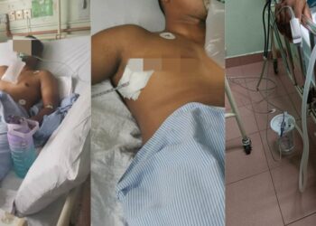 Paru-paru Pria Ini Bocor Gegara Rokok dan Vape, Ini Keluhan Awalnya