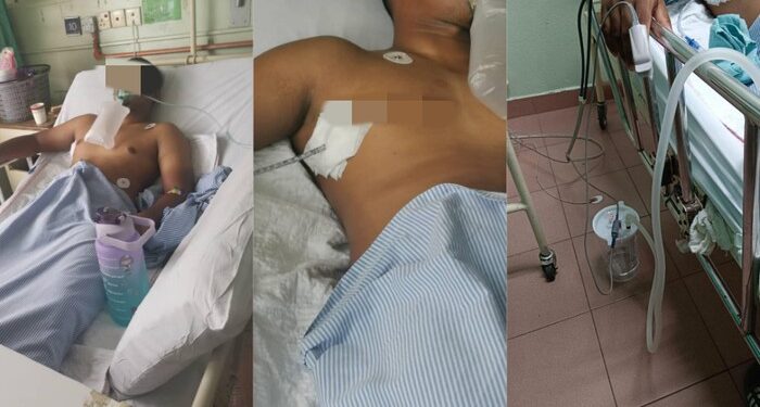 Paru-paru Pria Ini Bocor Gegara Rokok dan Vape, Ini Keluhan Awalnya