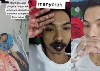 Terungkap, Ini Alasan Pria Madiun Viralkan Kondisinya yang Kena Flu Singapura