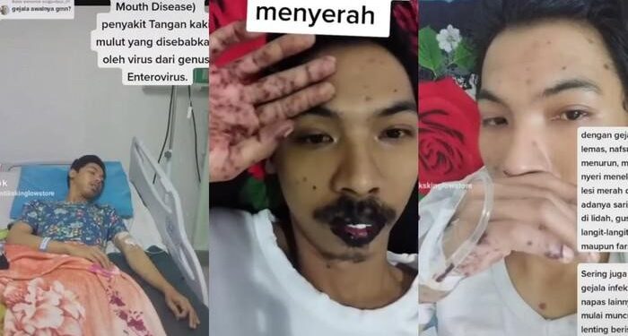 Terungkap, Ini Alasan Pria Madiun Viralkan Kondisinya yang Kena Flu Singapura