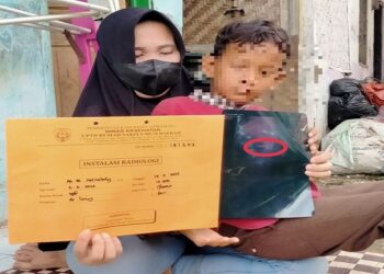Tak Sengaja Telan Kunci, Bocah 8 Tahun Butuh Bantuan Biaya Operasi