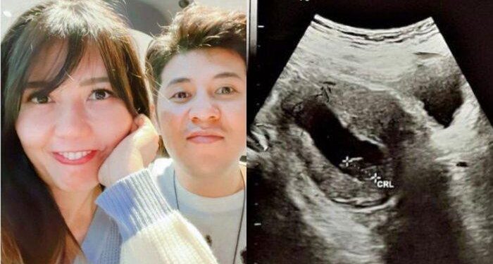 Via Vallen Keguguran setelah Berusaha Pertahankan Janinnya: Udah di Surganya Allah