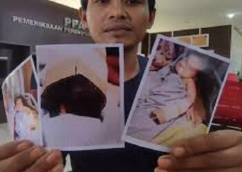 Kelalaian Oknum Perawat, Seorang Bayi di Palembang Terpotong Jari Kelingking