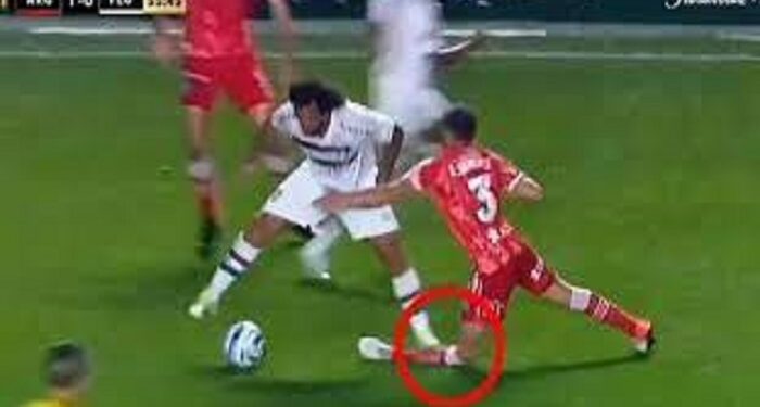 Insiden Horor, Pemain Sepak Bola Marcelo Injak Kaki Lawan Hingga Patah