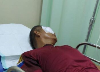 Diketapel Orang Tua Murid, Guru SMAN 7 Rejang Lebong Alami Buta Permanen
