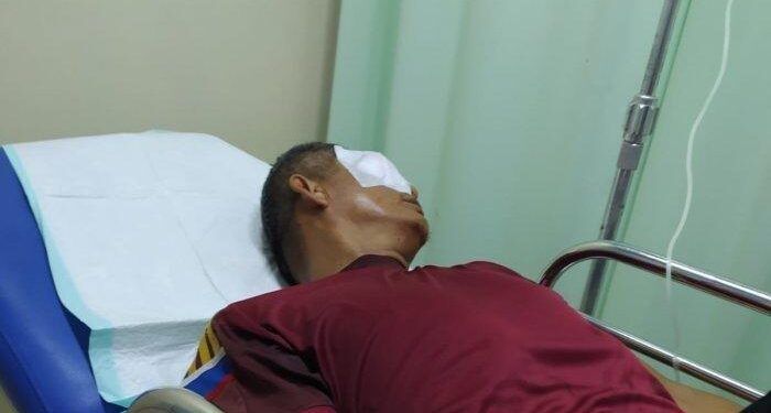 Diketapel Orang Tua Murid, Guru SMAN 7 Rejang Lebong Alami Buta Permanen