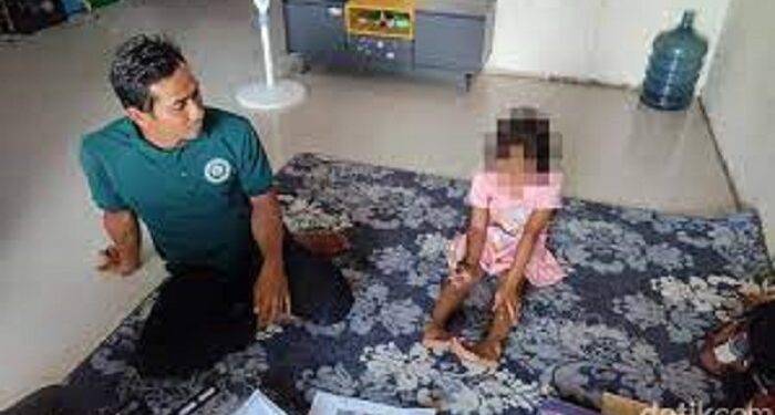 Seperti Normal, Siswi SD di Gresik Buta Permanen Usai Dicolok Tusuk Bakso