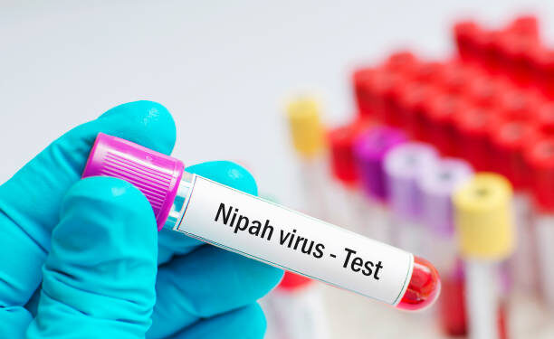 Hewan Ternak di Karimun Masih Aman dari Virus Nipah