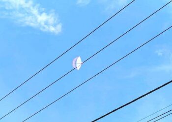 Tersengat Listrik Saat Main Layang-layang, Bocah di Karimun Alami Luka Bakar