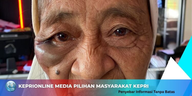 Seorang Nenek Usia 75 Tahun Jadi Korban Perampokan, Pelaku Pukul Korban Sampai Pingsan